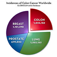 cáncer de colon